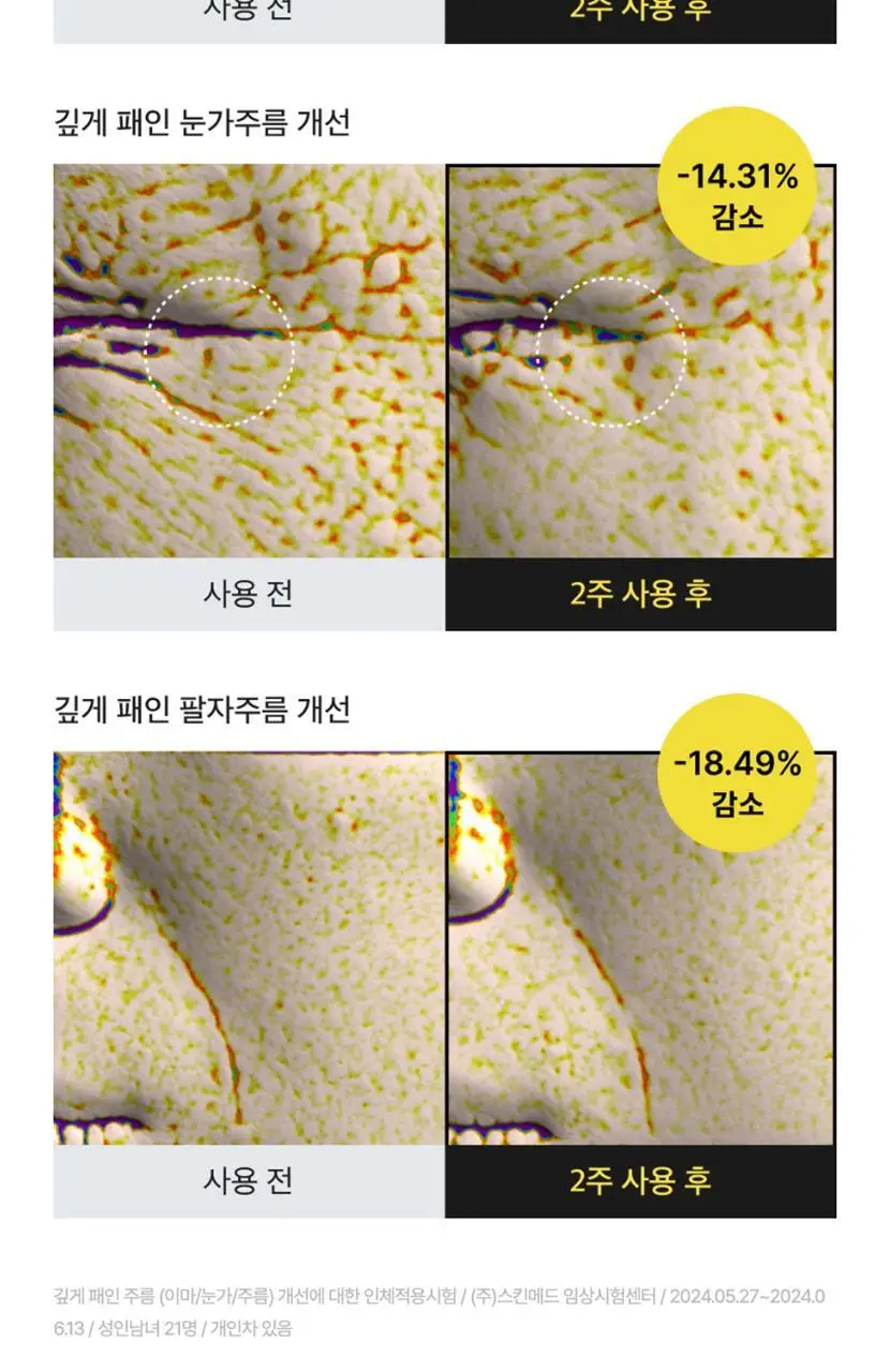 [모공탄력] 셀리맥스 더 비타 A 레티날 샷 타이트닝 부스터 15ml 상세페이지 33
